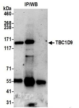 TBC1D9 Antibody