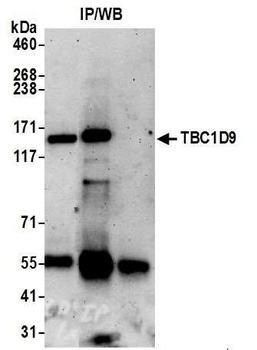 Rabbit anti-TBC1D9 Antibody