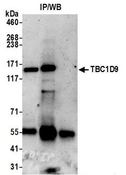 Rabbit anti-TBC1D9 Antibody