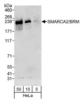 SMARCA2/BRM Antibody