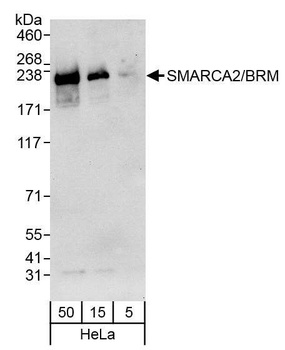Rabbit anti-SMARCA2/BRM Antibody