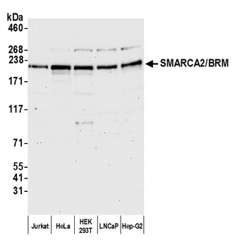 Rabbit anti-SMARCA2/BRM Antibody