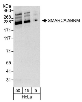 Rabbit anti-SMARCA2/BRM Antibody