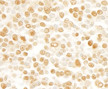 Rabbit anti-SFRS2IP Antibody