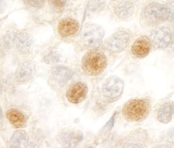 Rabbit anti-RBM10 Antibody