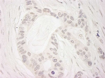 Rabbit anti-BubR1 Antibody