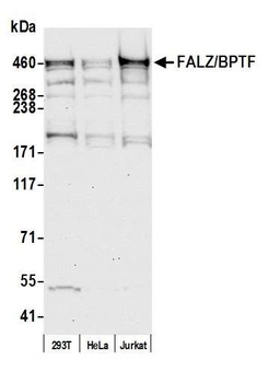 FALZ/BPTF Antibody