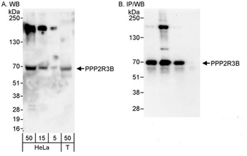 Rabbit anti-PPP2R3B Antibody
