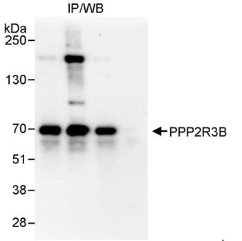 Rabbit anti-PPP2R3B Antibody