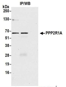 PPP2R1A Antibody