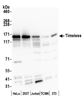 Timeless Antibody