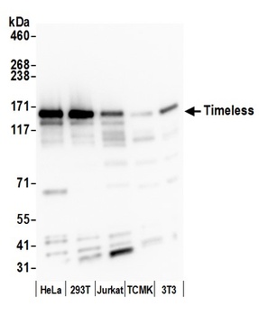 Rabbit anti-Timeless Antibody