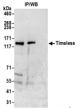 Rabbit anti-Timeless Antibody