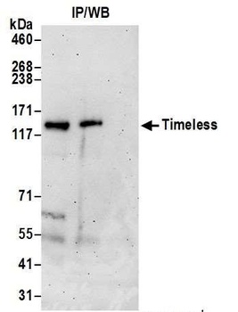 Timeless Antibody