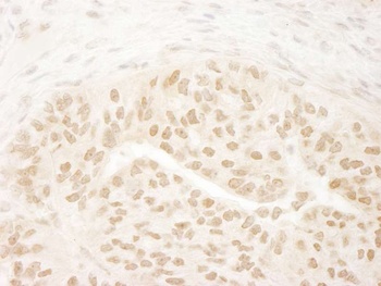 Rabbit anti-DOT1L Antibody