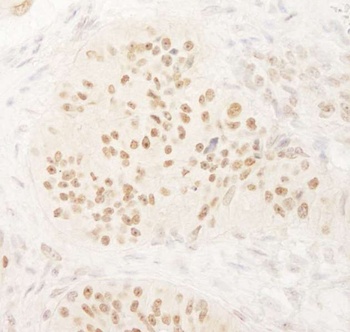 Rabbit anti-KIFC1 Antibody
