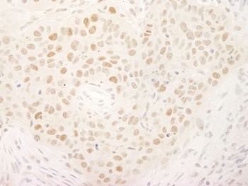 Rabbit anti-KIFC1/MKLP2 Antibody