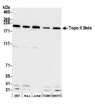 Topo II Beta Antibody