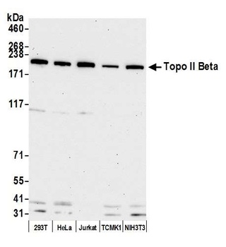 Rabbit anti-Topo II Beta Antibody
