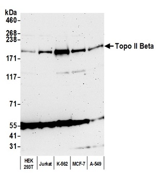 Topo II Beta Antibody