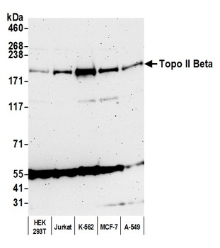 Rabbit anti-Topo II Beta Antibody