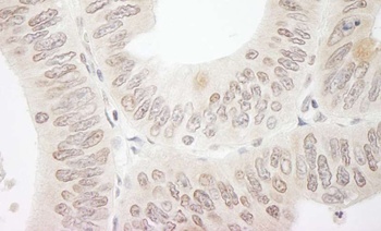 Rabbit anti-DTL/CDT2 Antibody
