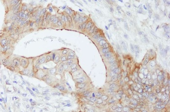 Rabbit anti-SPTBN1 Antibody
