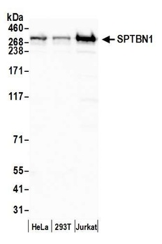 Rabbit anti-SPTBN1 Antibody