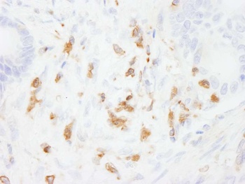 Rabbit anti-Coronin 1 Antibody