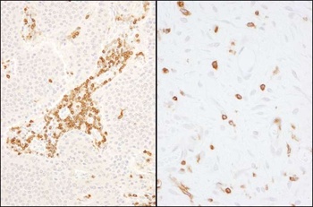 Rabbit anti-Coronin 1 Antibody