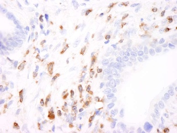 Rabbit anti-Coronin 1 Antibody