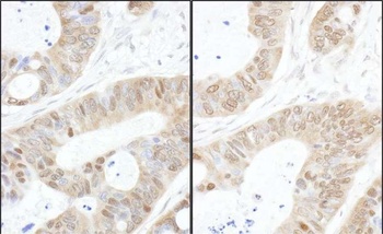 Rabbit anti-USP14 Antibody