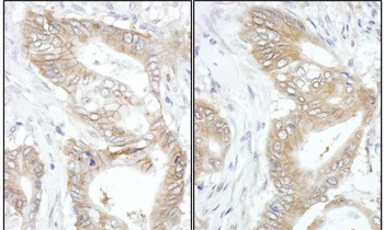 USP14 Antibody