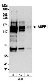 ASPP1 Antibody