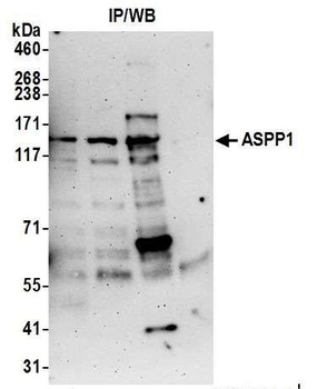 ASPP1 Antibody
