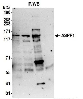 Rabbit anti-ASPP1 Antibody