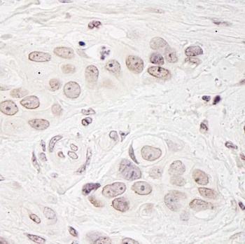 Rabbit anti-BCAS3 Antibody