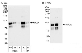 Rabbit anti-KIF2A Antibody