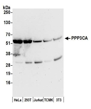 Rabbit anti-PPP3CA Antibody