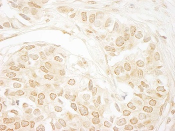 Rabbit anti-PPP3CA Antibody