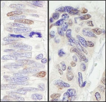 Rabbit anti-Pescadillo Antibody