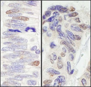 Pescadillo Antibody