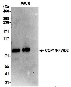COP1/RFWD2 Antibody