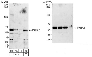 Rabbit anti-P4HA2 Antibody