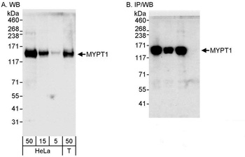 MYPT1 Antibody