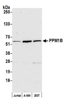 PPM1B Antibody