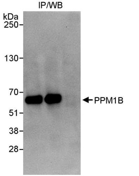 Rabbit anti-PPM1B Antibody