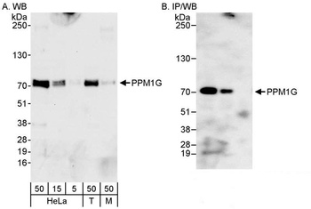 Rabbit anti-PPM1G Antibody