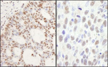 PPM1G Antibody