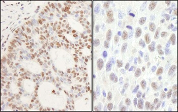 Rabbit anti-PPM1G Antibody